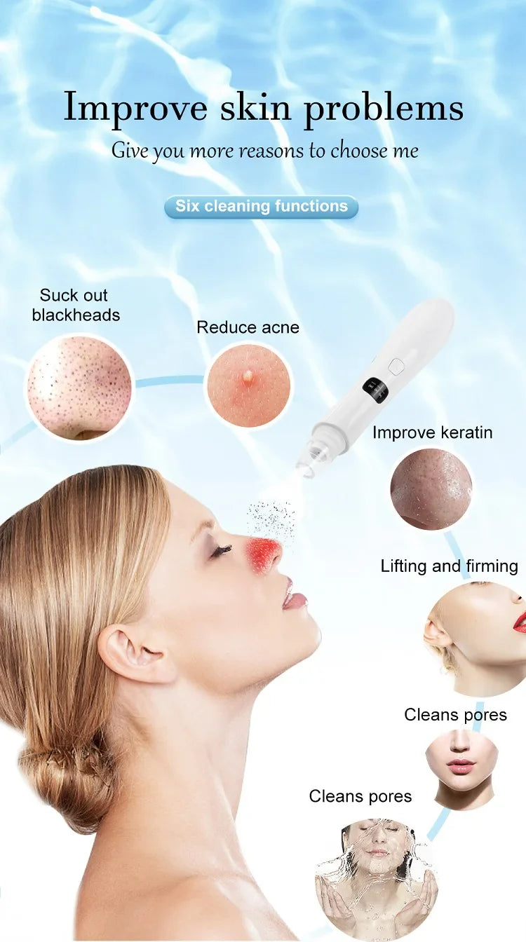 Removedor de Cravos Elétrico 3 Níveis – Limpeza Facial Profunda & Rejuvenescimento
