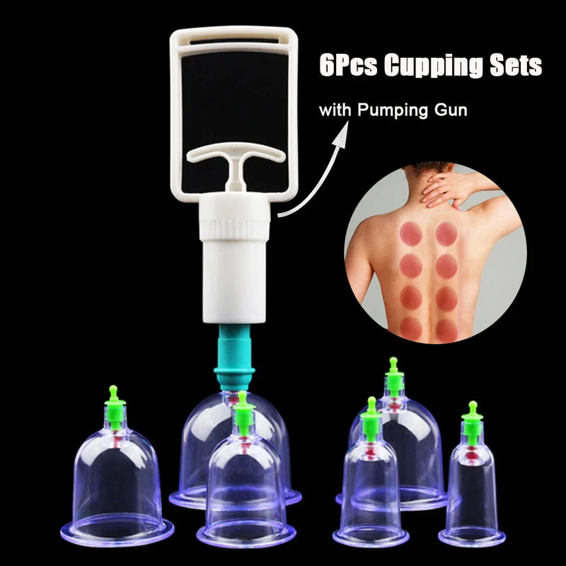 Kit de Ventosas a Vácuo 6 Peças com Bomba Manual – Massagem, Detox e Terapia Anticelulite