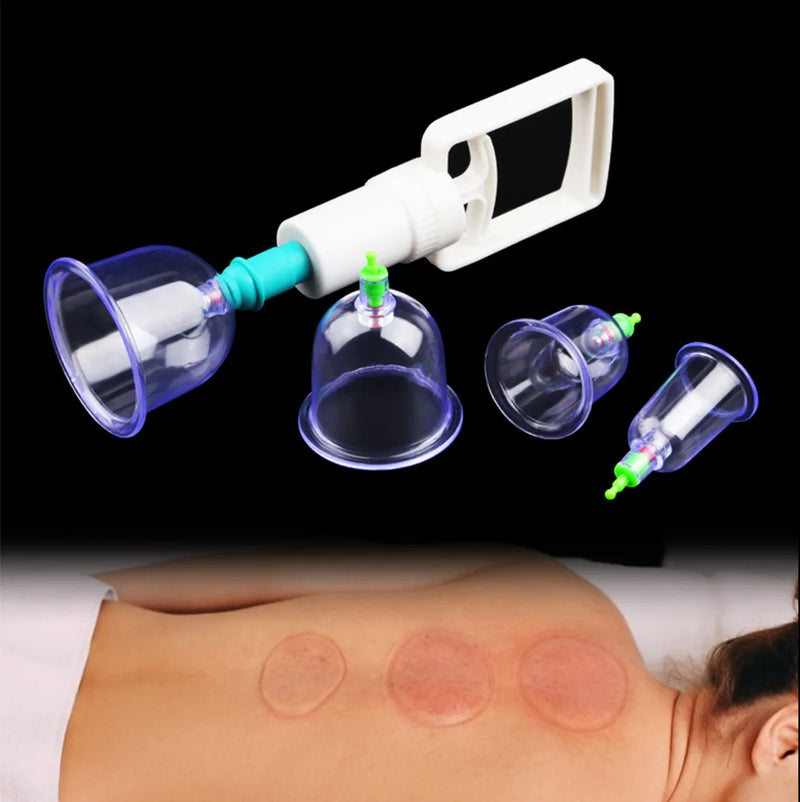 Kit de Ventosas a Vácuo 6 Peças com Bomba Manual – Massagem, Detox e Terapia Anticelulite