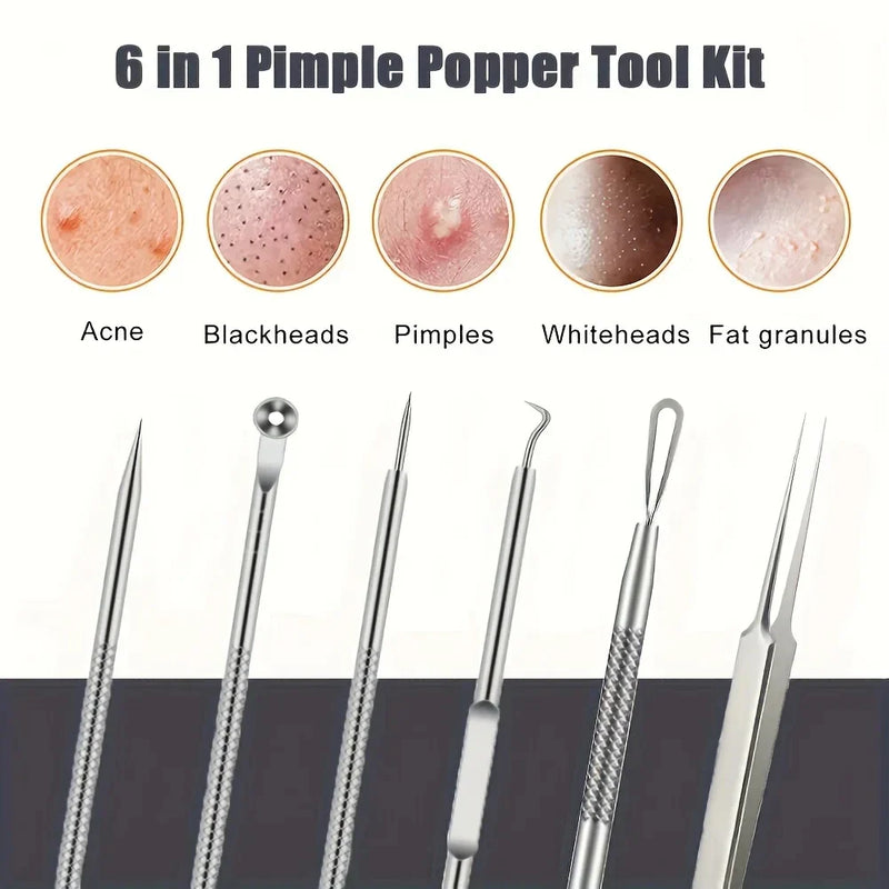 Kit Removedor de Cravos e Espinhas – 6 Peças Profissionais em Aço Inoxidável